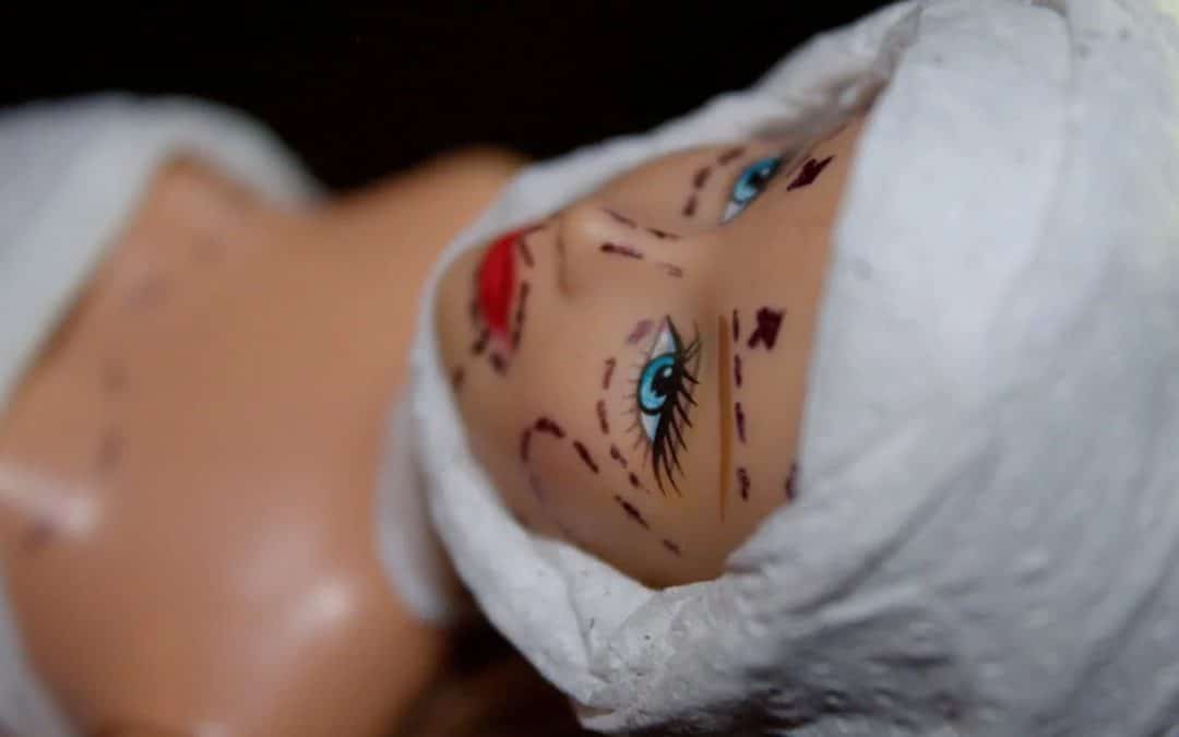 À partir de quel âge peut-on envisager un lifting du visage ?