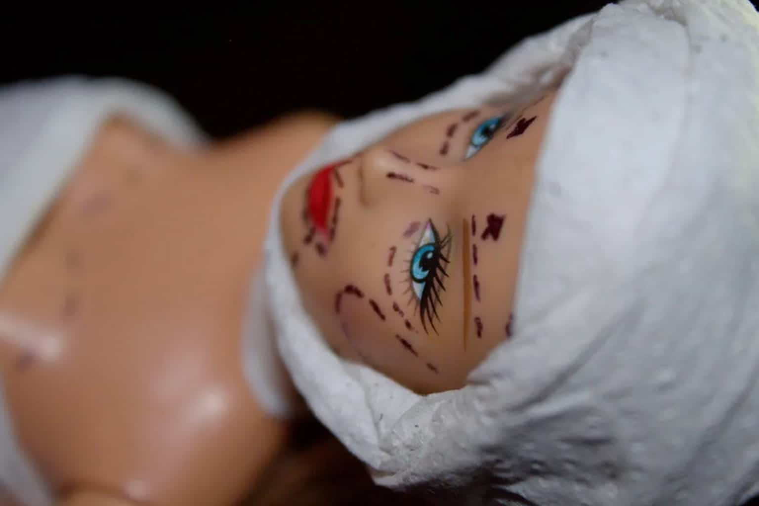 À partir de quel âge peut-on envisager un lifting du visage ?